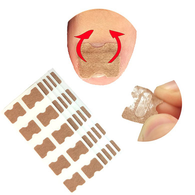 Ingrown Toenail Treatment, 50Pcs Ingrown Toenail Correction Stickers, Health Toenail Corrector Patches, Professional Glue-Free Toe Nail Treatment Tool,Foot Care50Pcs Toenailcorrection Stickers
