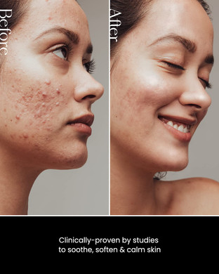 Son&Park Beauty Water 340Ml (11.49 Fl. Oz) | Multi-Purpose Toner For Oil Control Hydrating Exfoliating Skincare Daily Cleansing Booster With Rose Water Witch Hazel Lavender Oil