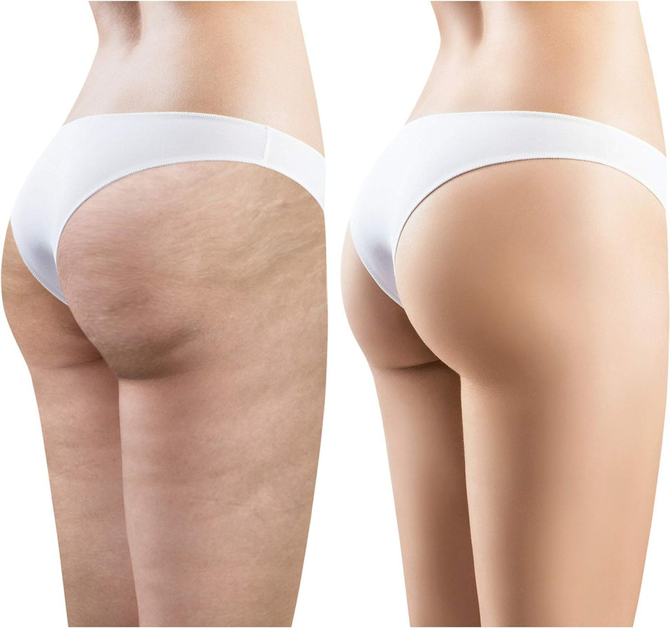 All Naturals, Anti-Cellulite Organic Body Balm. Intensive Body Shaper With With Caffeine, Microalgea, Andiroba Oil, 200 Ml