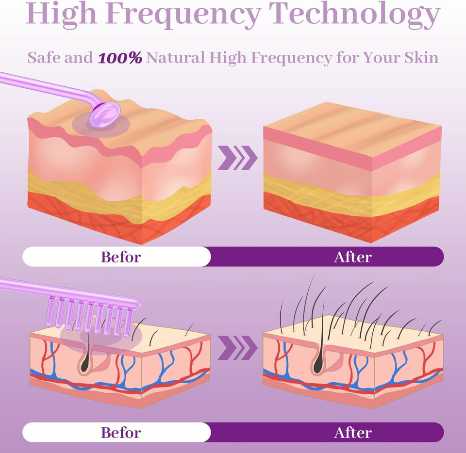 High Frequency Facial Wand - Tumakou Violet Portable Handheld High Frequency Facial Skin Machine Device For Face - With 4 Purple Tubes High Frequency Facial Wand - Tumakou Violet Portable Handheld High Frequency Facial Skin Machine Device For Face - With 4 Purple Tubes