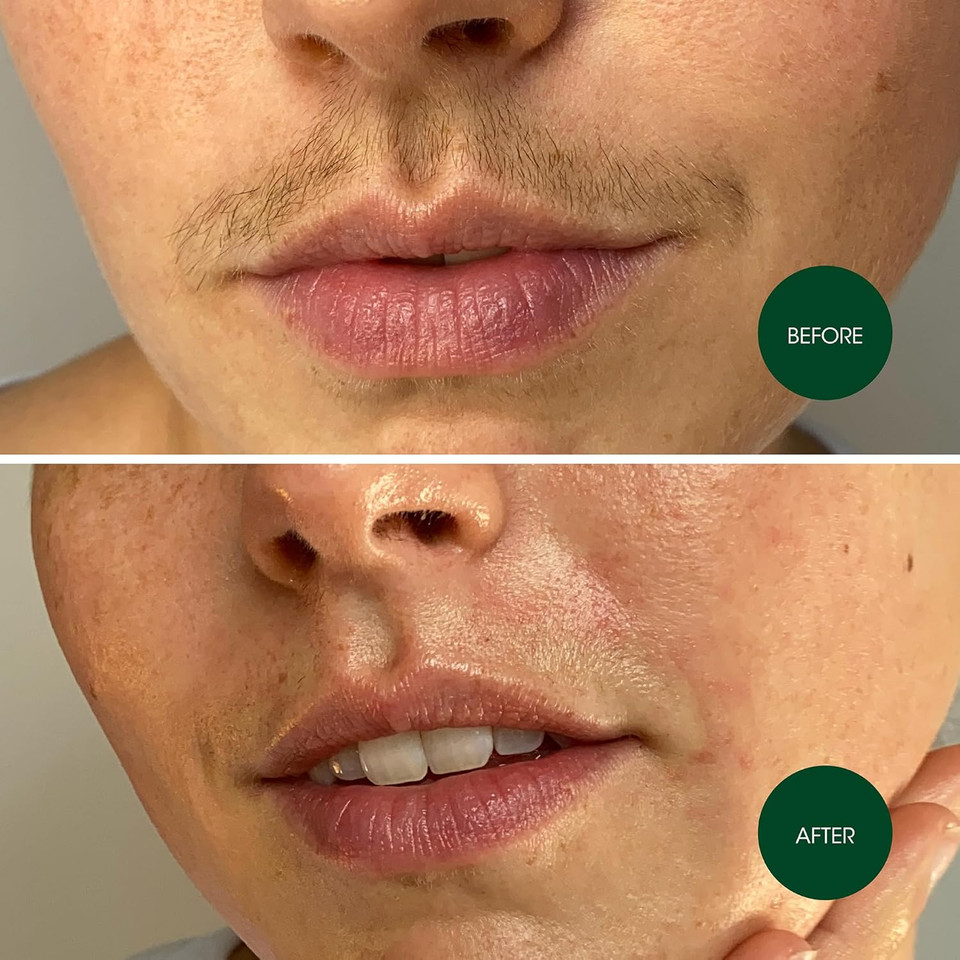 Nad'S Facial Wax Strips - Facial Hair Removal For Women - Waxing Kit With 48 Face Wax Strips + 8 Calming Oil Wipes + Skin Protection Powder