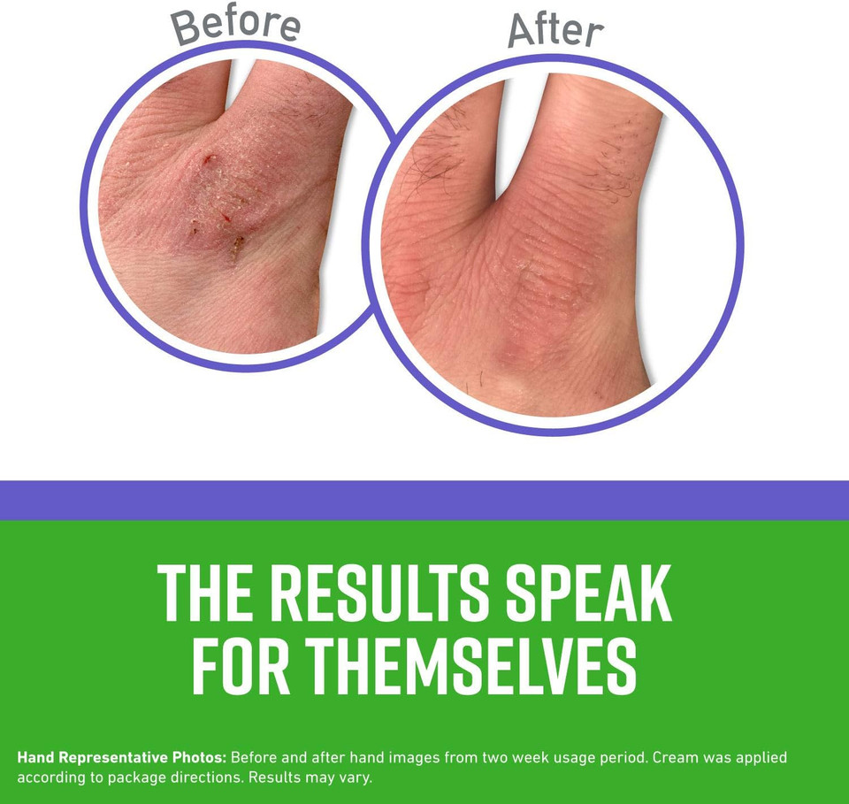 O'Keeffe'S Working Hands Night Treatment Hand Cream, 7 Oz Tube, (Pack Of 2)