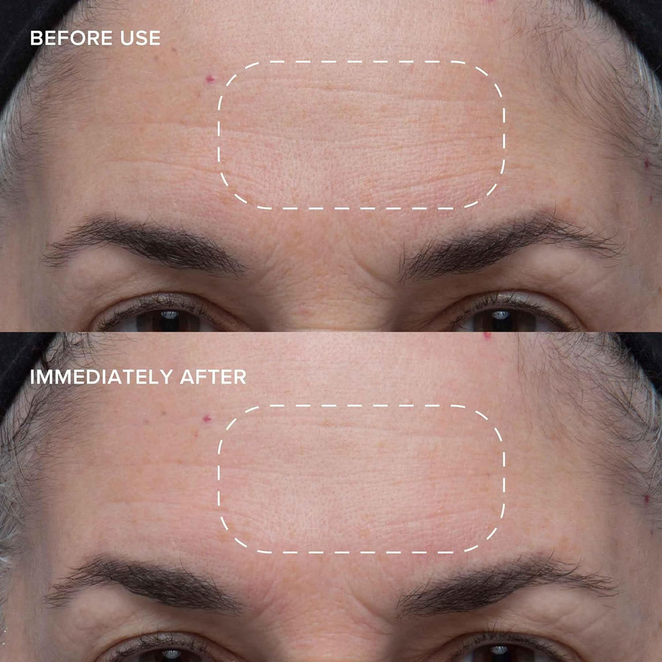 Alpyn Beauty Wild Huckleberry 8-Acid Polishing Peel | Double Exfoliating Peel Mask To Visibly Smooth & Brighten Skin While Refining The Look Of Pores | 1.7 Oz / 50 Ml