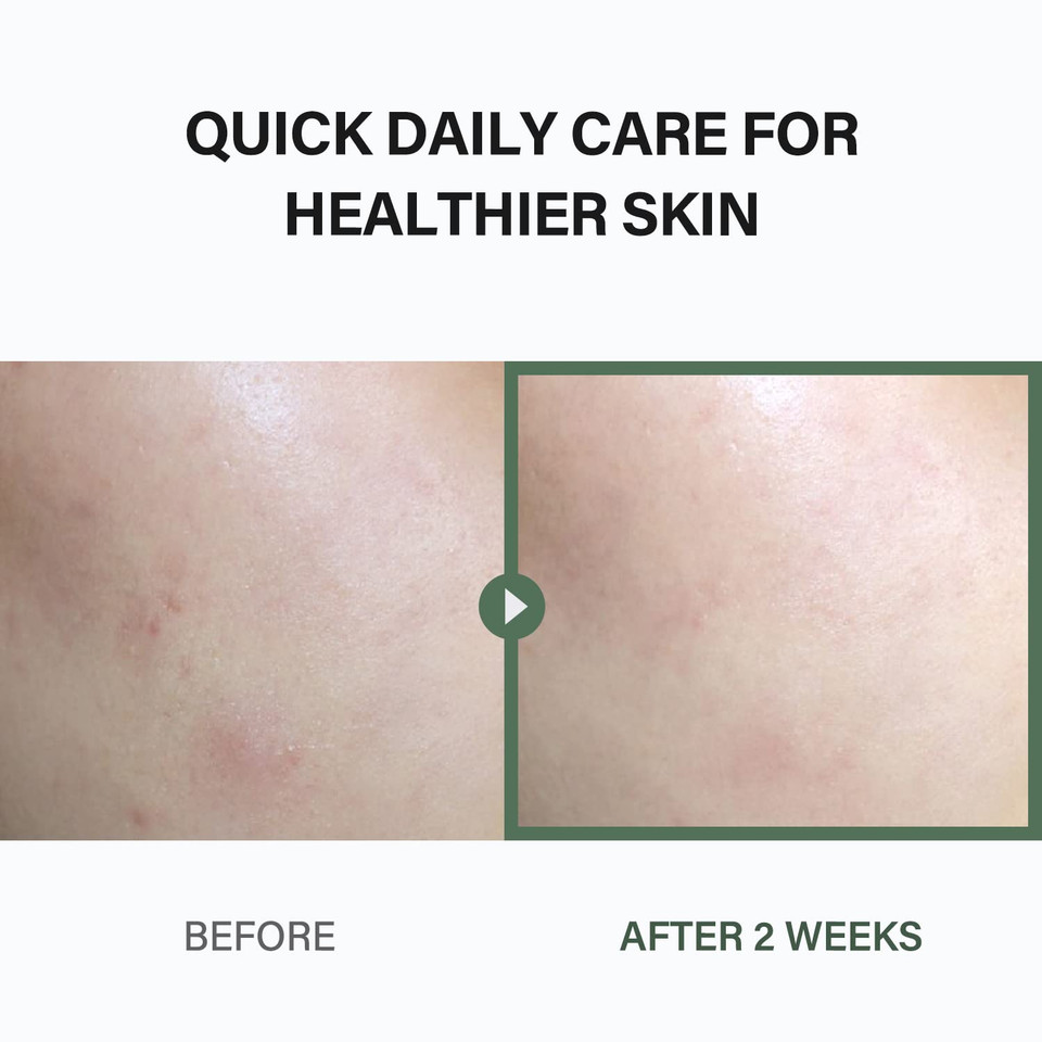 Celimax Ji.Woo.Gae Heartleaf Bha Peeling Pad (60 Pads*2) & The Real Noni Energy Ampoule 50Ml