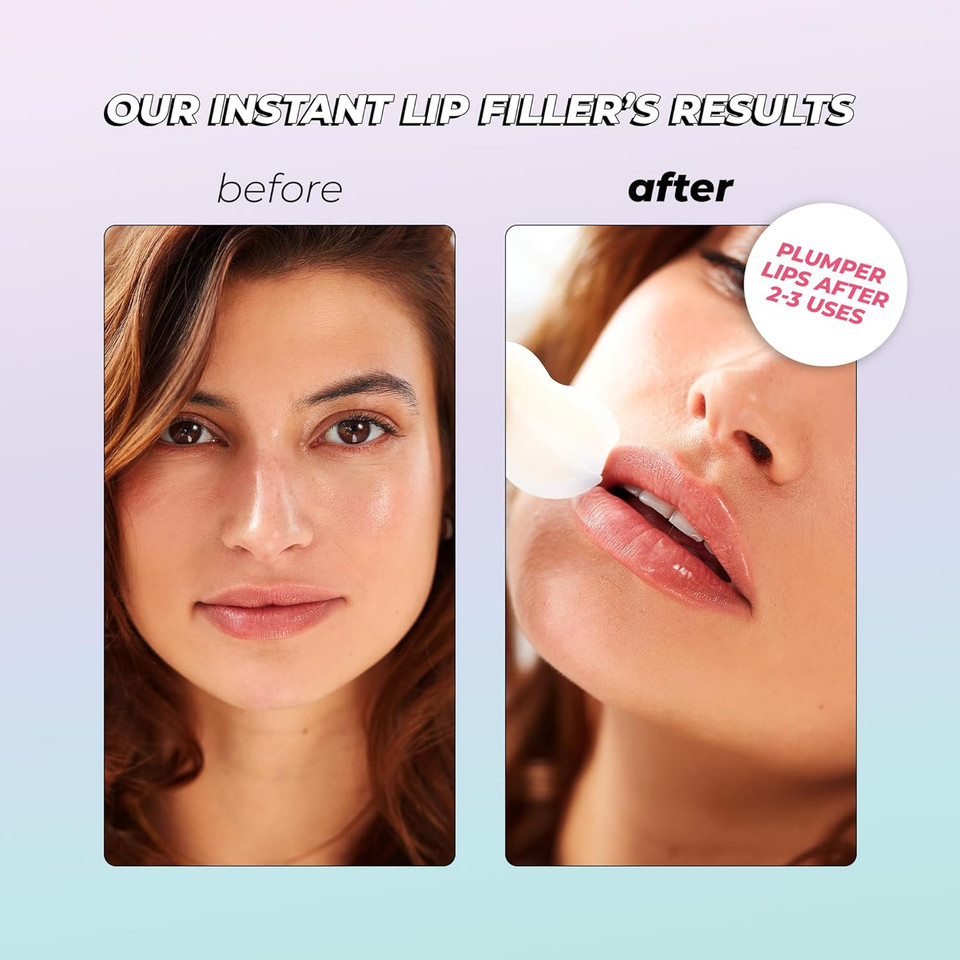 Instant Lip Filler For Plumped Lips In 30 Mins By Vitamasques, 3 Pack - Vegan Collagen, Multi-Molecular Hyaluronic Acid & 400 Dissolving Micro-Dart Technology For Instant & Long-Lasting Results1 Count (Pack Of 3)