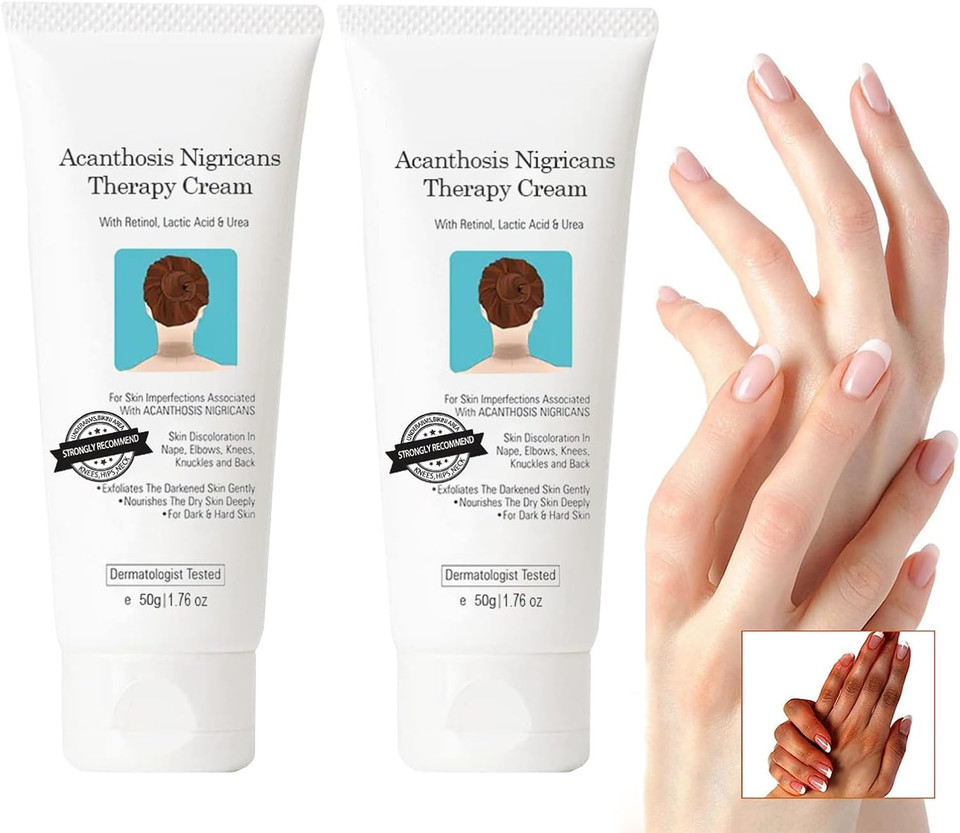 Acanthosis Nigricans Therapy Cream - Dark Spot Corrector & Remover For Hyperpigmentation On Neck, Ankles, Knuckles, Armpits, Thighs & Elbows With Lactic Acid2Pcs X 50G