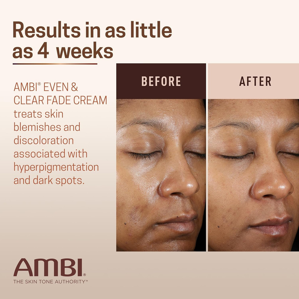 Ambi Even & Clear Fade Cream, Hydroquinone-Free, Hyperpigmentation Treatment, Dark Spot Corrector, Results In As Little As 4 Weeks, Niacinamide, Aloe Vera, Vitamin C, 1 Fl Oz
