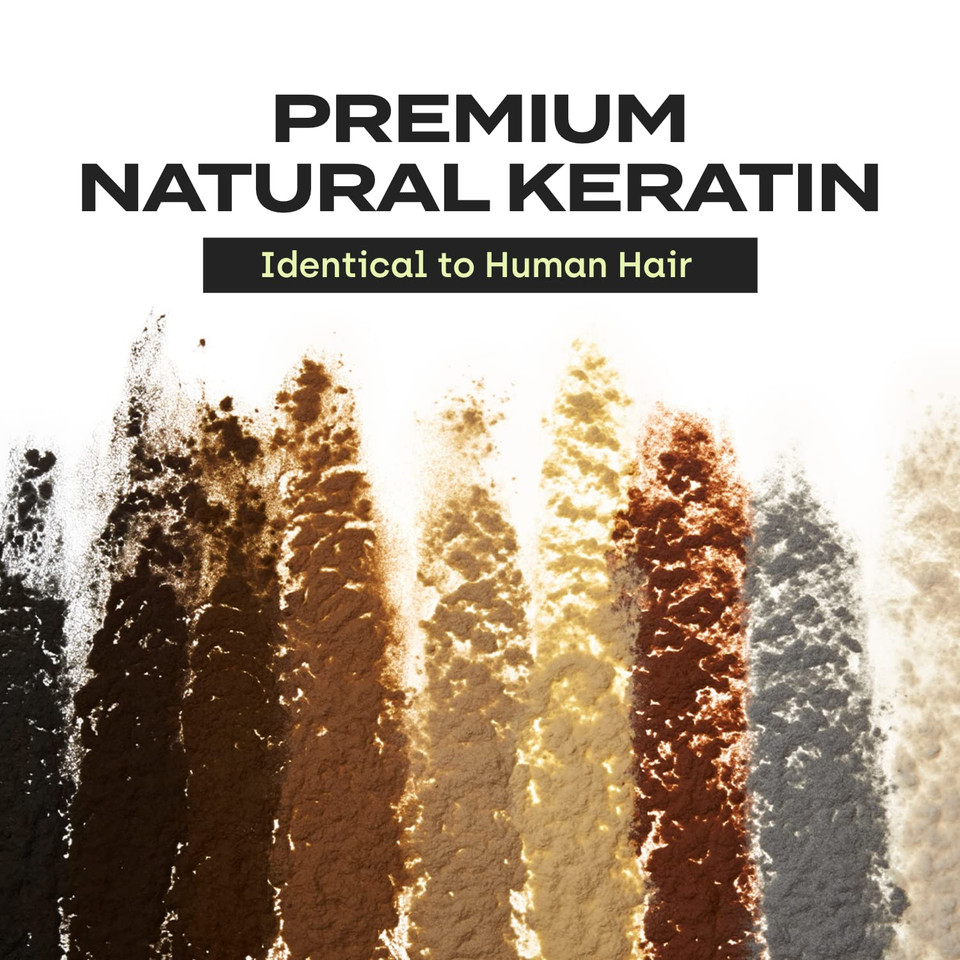 Toppik Hair Building Fibers, White, 27.5G, Fill In Fine Or Thinning Hair, Instantly Thicker, Fuller Looking Hair, 9 Shades For Men & Womenwhite