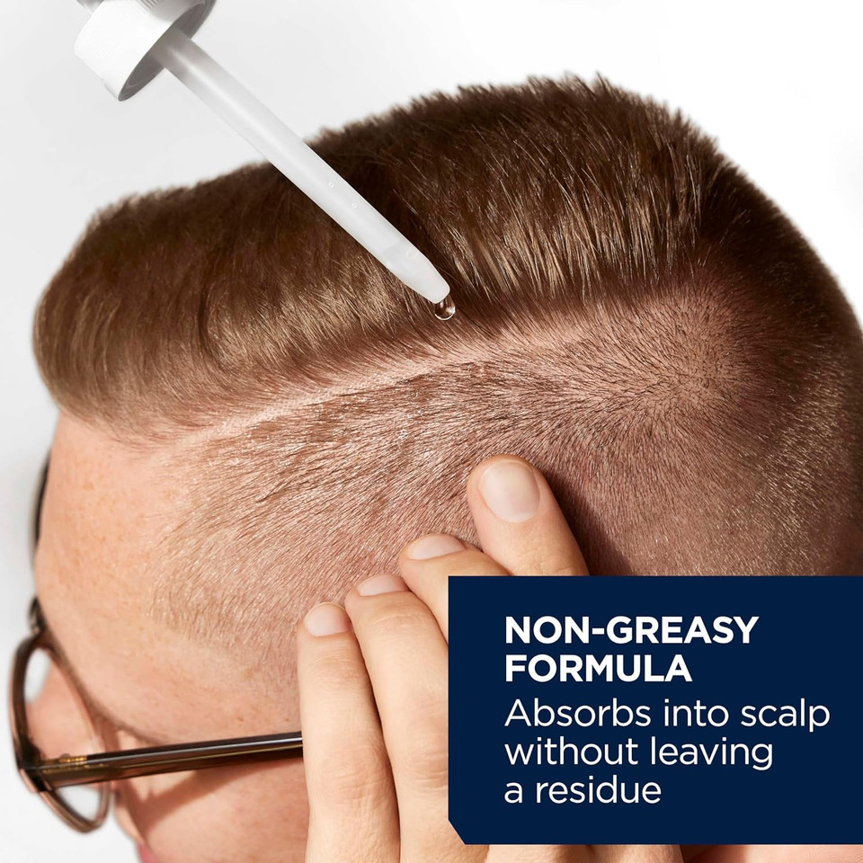 Head & Shoulders Scalp X 5% Minoxidil For Men, Hair Regrowth Treatment For Thinning Hair And Hair Loss, Topical Solution, 3 Month Supply, 2 Fl Oz Each, Pack Of 3