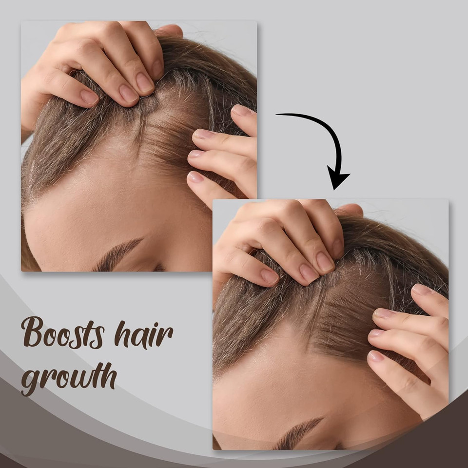 Herstyler Castor Oil Hair Serum For Hair Growth - Hair Shine Serum With Vitamin E - Hair Growth Serum - Argan Oil Hair Serum For Frizzy Hair - Vitamin E Hair Serum For Silky Hair Herstyler Castor Oil Hair Serum For Hair Growth - Hair Shine Serum With Vitamin E - Hair Growth Serum - Argan Oil Hair Serum For Frizzy Hair - Vitamin E Hair Serum For Silky Hair