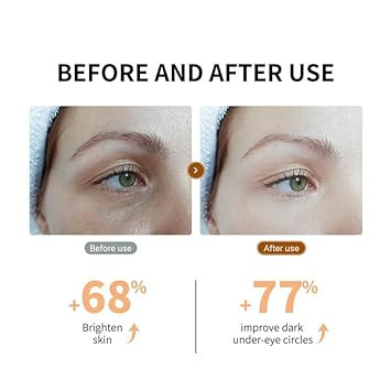 Lanbena Under Eye Patches - 30 Pairs Vitamin C Eye Mask- Puffy Eyes & Dark Circles Treatments, Reduce Under Eye Bags And Smooth Wrinkles, Eye Skin Care Pads With Collagen