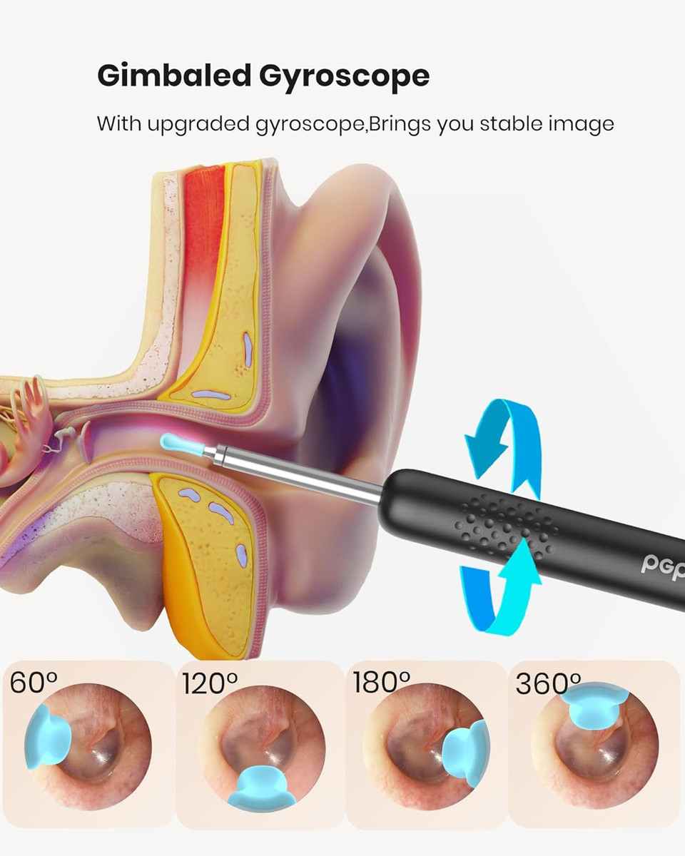 Bebird R1 Ear Wax Removal Tool - Spade Ear Cleaner With Ear Camera, 1080P Ear Scope, Earwax Remover Picker With 10 Replacement Tips Ear Pick With 6 Led Light For Earwax Cleaning, Support Iphone, Black