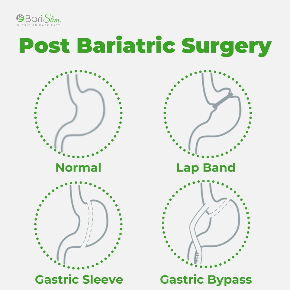Once Daily Bariatric Multivitamin Capsule - 45Mg Of Iron - Bariatric Vitamin & Supplement For Post Bariatric Surgery Including Gastric Bypass & Gastric Sleeve | 30-Day Supply