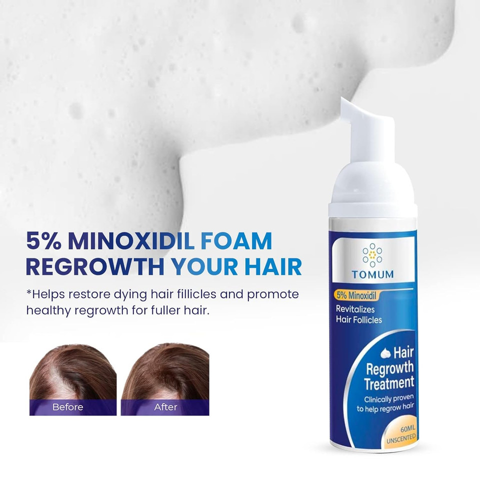 5% Minoxidil Foam for Men and Women Topical Hair Loss treatments Hair Growth Serum- Slows Hair Loss & Promotes Regrowth For Thicker, Longer Hair 2 Month Supply