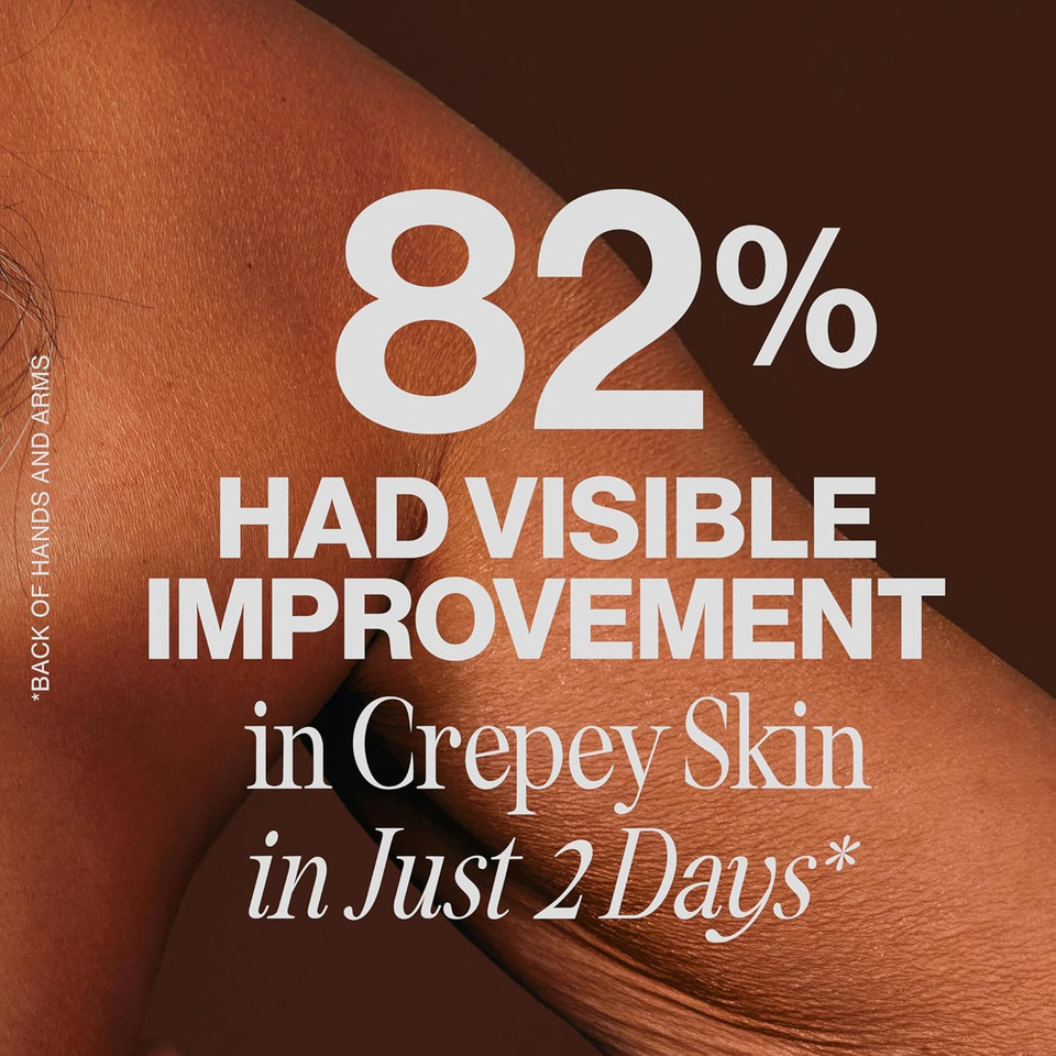 Gold Bond Age Renew Crepe Corrector Body Lotion, Replenishing & Smoothing Formula, 8 Oz