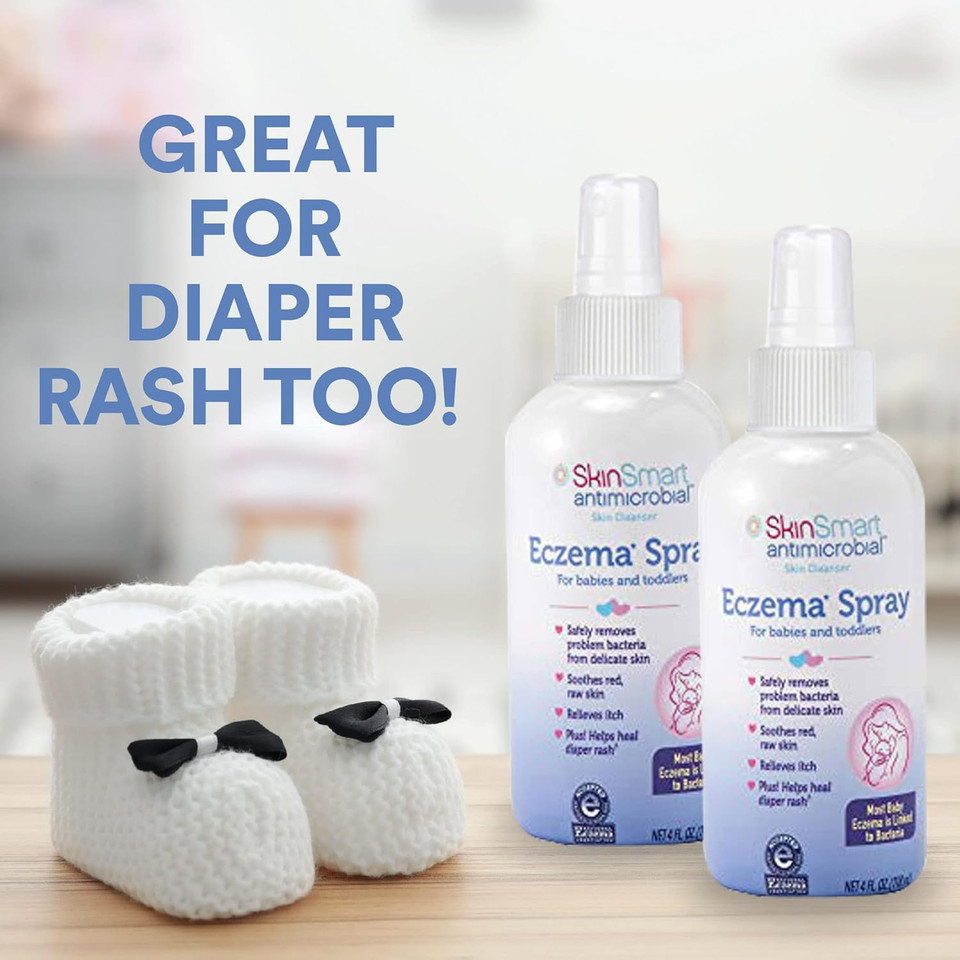 Skinsmart Eczema Spray For Babies And Toddlers, Removes Bacteria So Skin Can Heal, 4 Ounce Spray (Pack Of 2) Safe For Delicate And Raw Skin