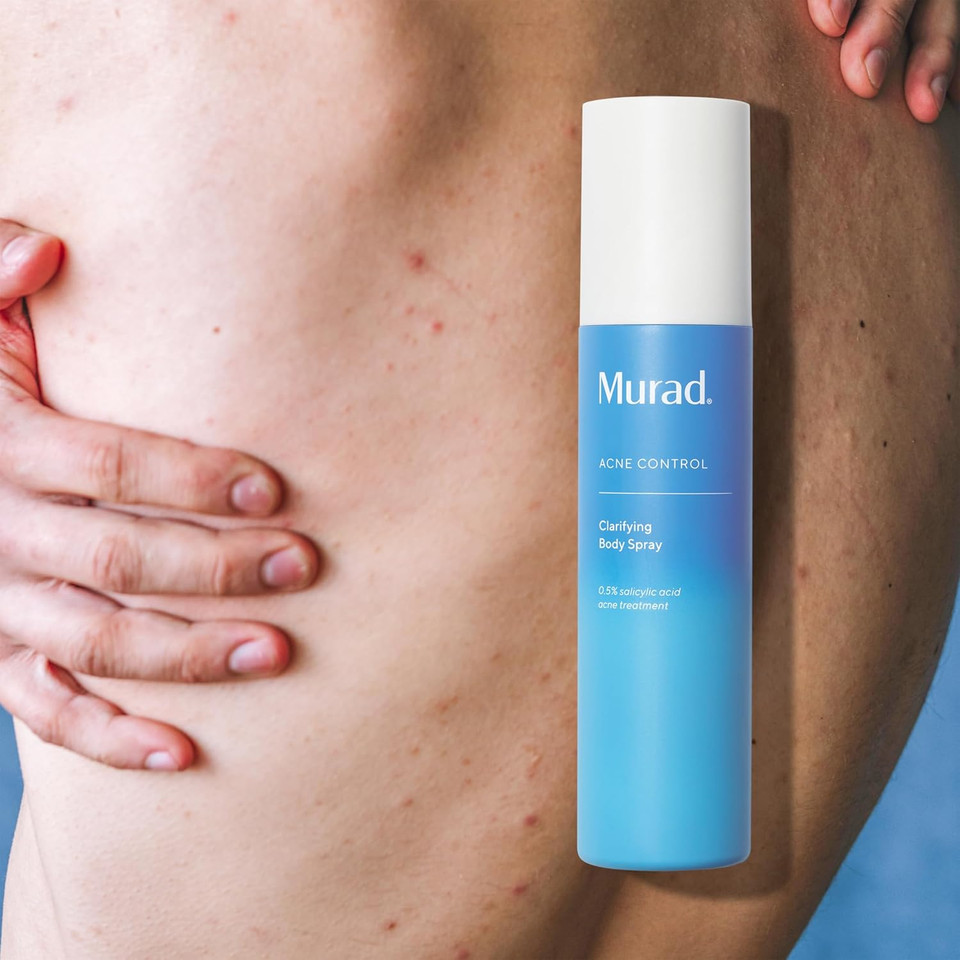 Murad Clarifying Body Spray - Daily Salicylic Acid Treatment To Clear And Prevent Body Acne And Breakouts, 6Fl Oz