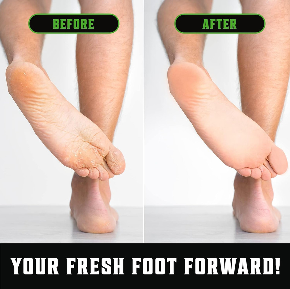 Viking Revolution Tea Tree Body Wash Soap For Men - Helps Athlete'S Foot, Jock Itch, Eczema & Body Odors - Extra Strength Tea Tree Oil Men'S Body And Foot Wash Viking Revolution Tea Tree Body Wash Soap For Men - Helps Athlete'S Foot, Jock Itch, Eczema & Body Odors - Extra Strength Tea Tree Oil Men'S Body And Foot Wash