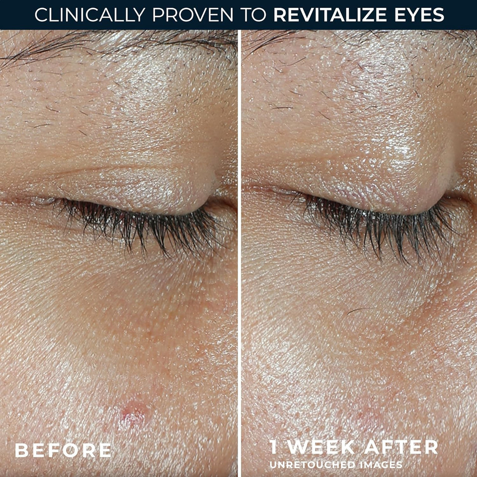 Roc Multi Correxion Revive + Glow Vitamin C Eye Balm (0.14 Oz) With Retinol Eye Cream Packette