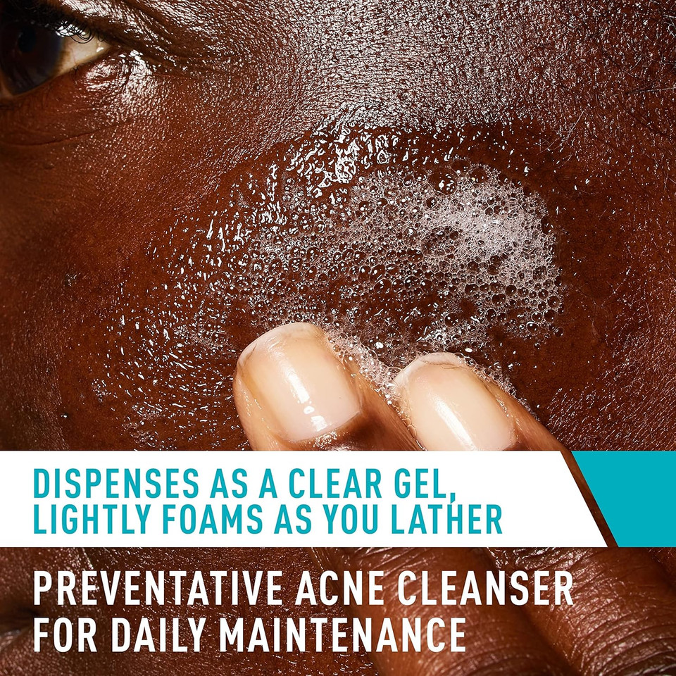 Cerave Acne Treatment Face Wash | Salicylic Acid Cleanser With Purifying Clay, Niacinamide, And Ceramides | Pore Control And Blackhead Remover | 8 Ounce