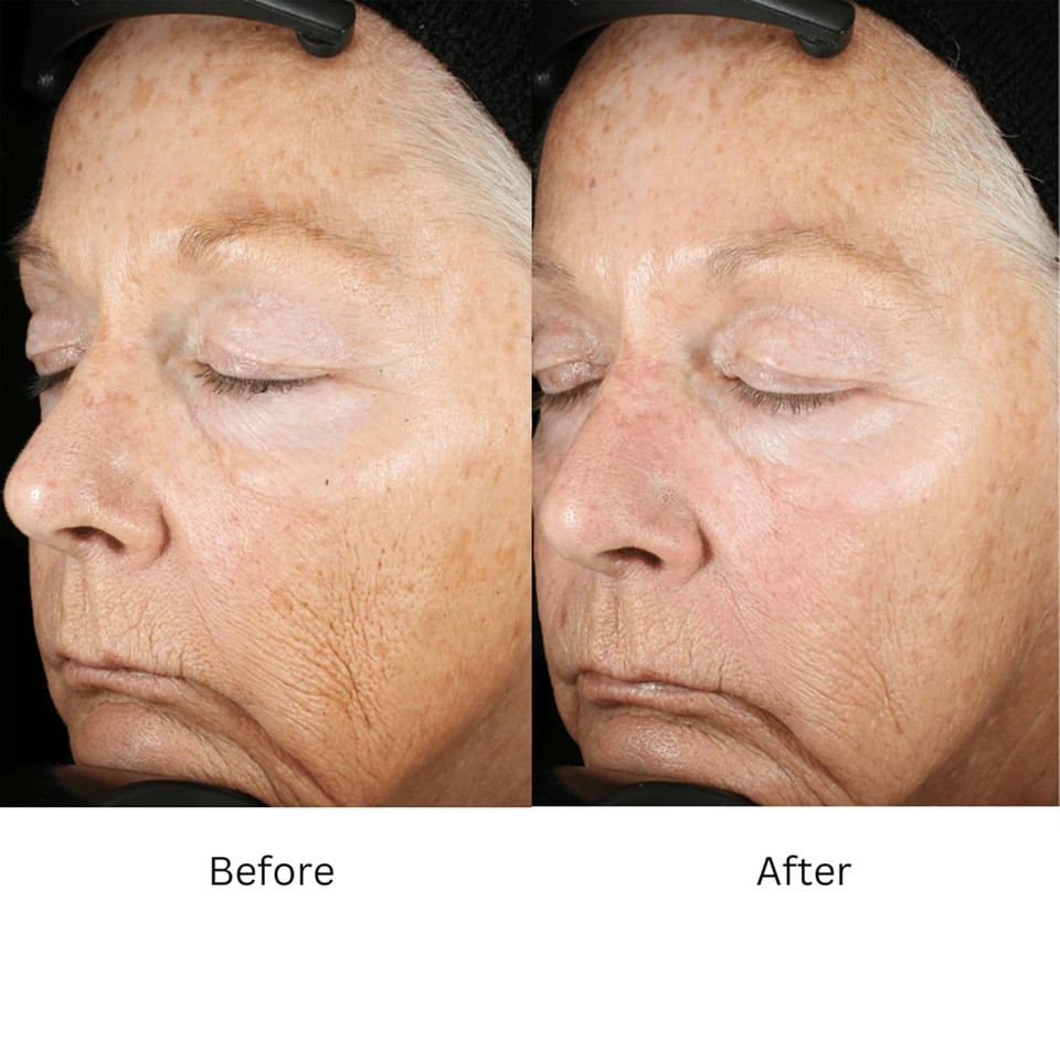 Zo Skin Health Wrinkle + Texture Repair