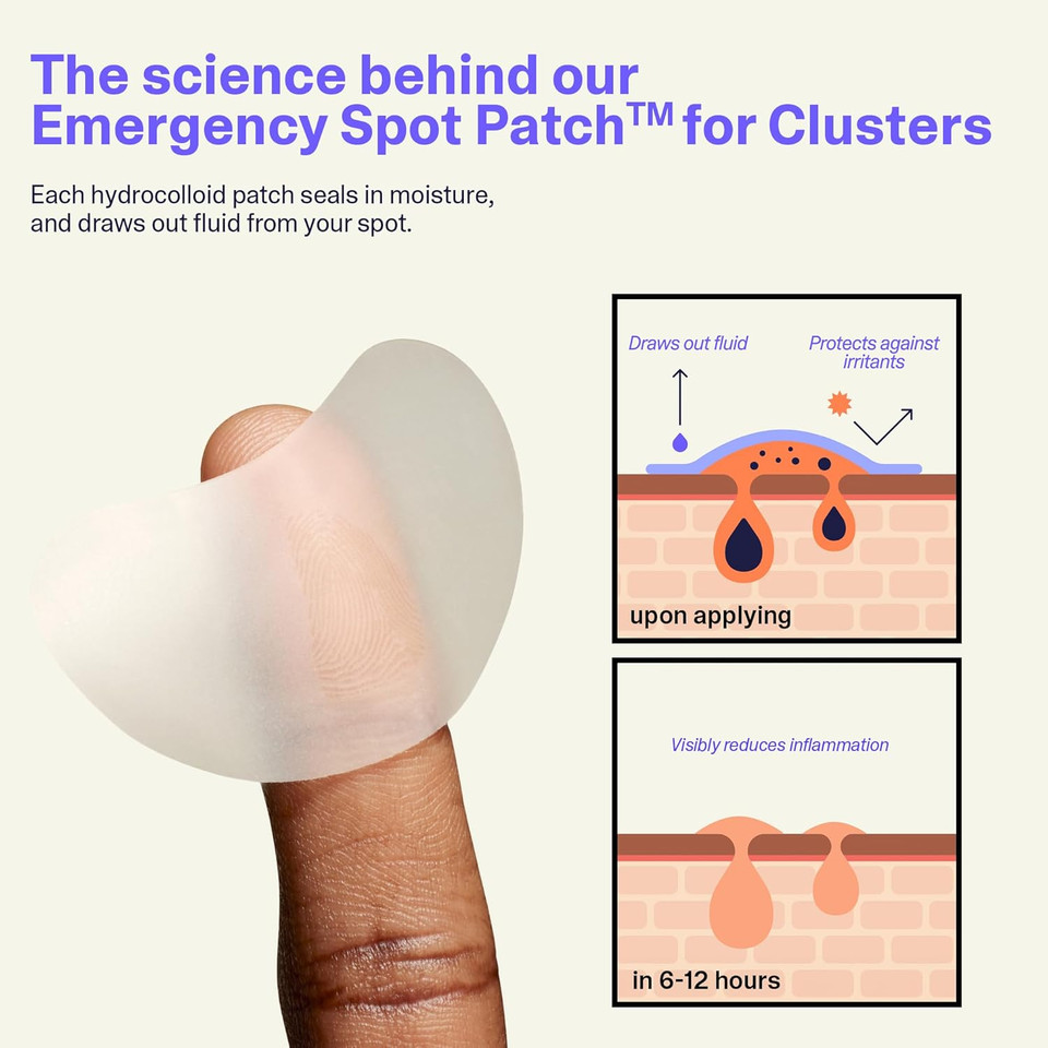 Curology Emergency Spot Patch Clusters, Large Hydrocolloid Pimple Patches For Face, Fast-Acting Support, Spot Concealing And Oil Absorbing, Pack Of 14