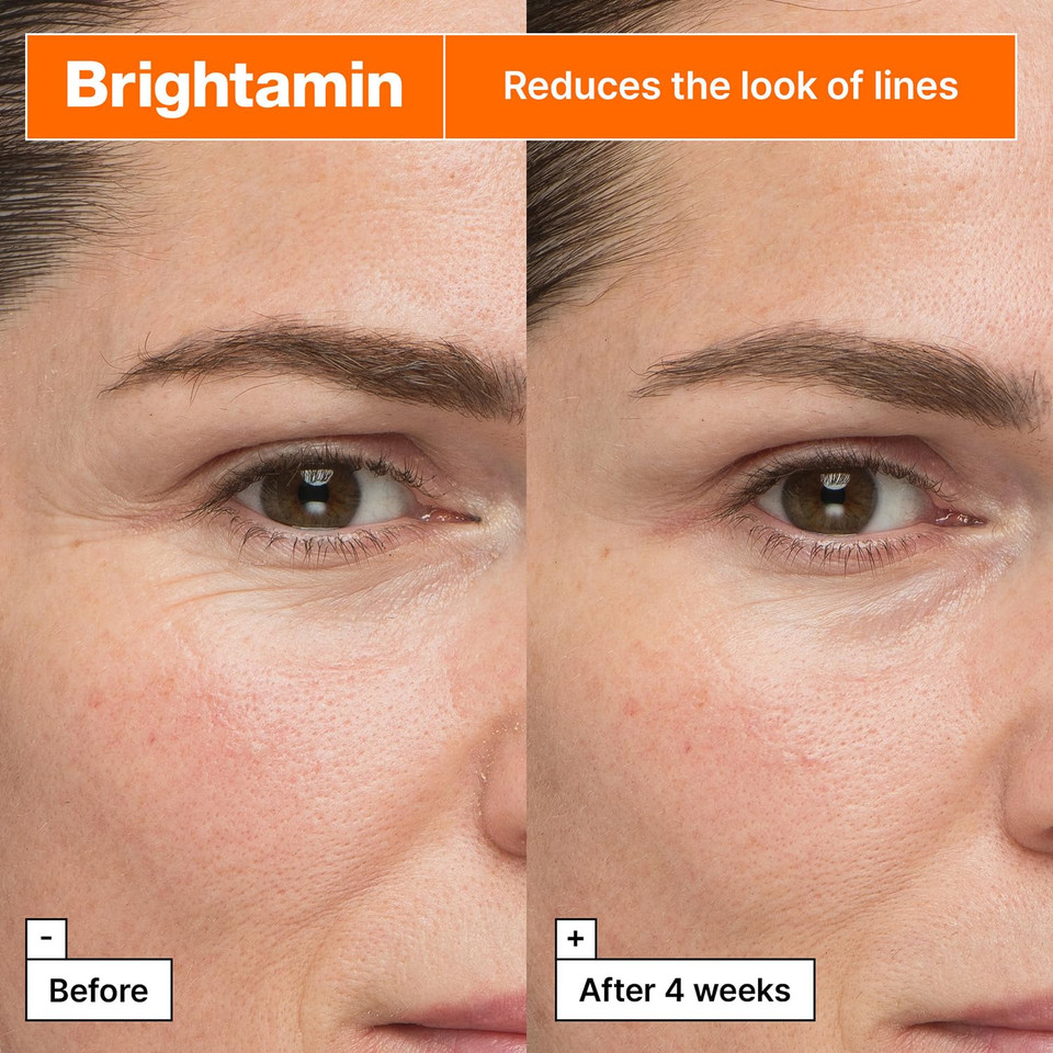 Dr.Jart+ Brightamin Brightening Serum For Visible Fine Lines With Vitamin C And Niacinamide | Korean Skin Care, 1 Count