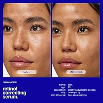 Malin + Goetz Retinol Correcting Serum, 1Oz, 30 Ml  Face Serum For Sensitive Skin Types, Brightening Serum For Face, Anti-Aging Serum, Facial Serum, Retinol Cream For Face, Vegan & Cruelty Free