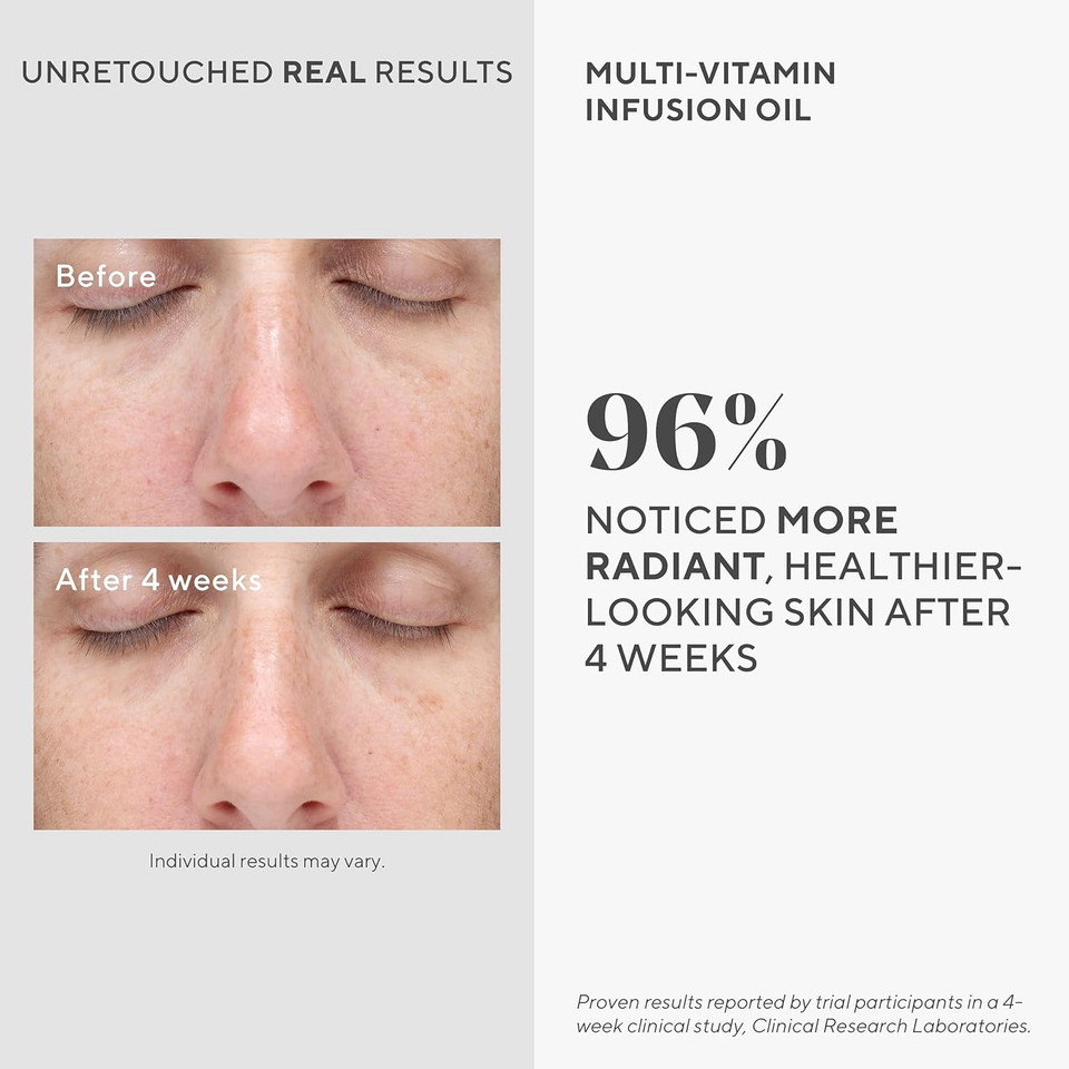 Murad Multi-Vitamin Infusion Facial Oil - Hydration Absorbs Quickly And Moisturizes With Vitamins A-F - Anti-Aging Skin Treatment Backed By Science