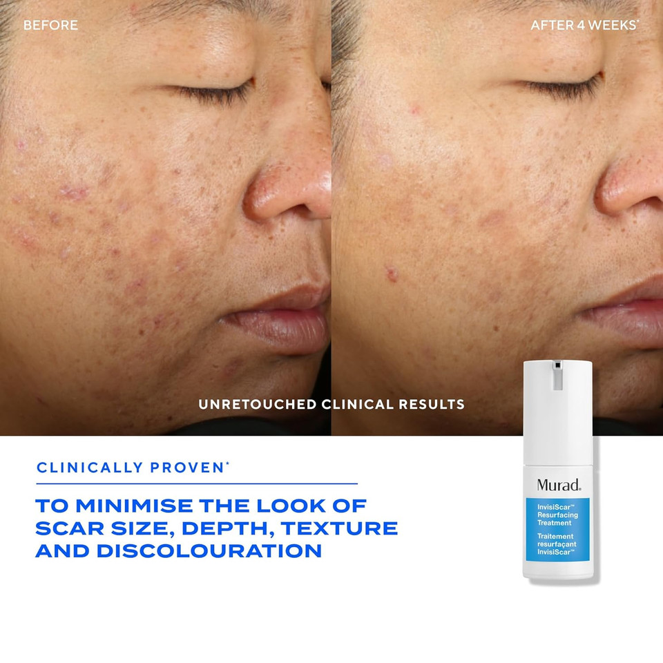 Murad Invisiscar Resurfacing Treatment