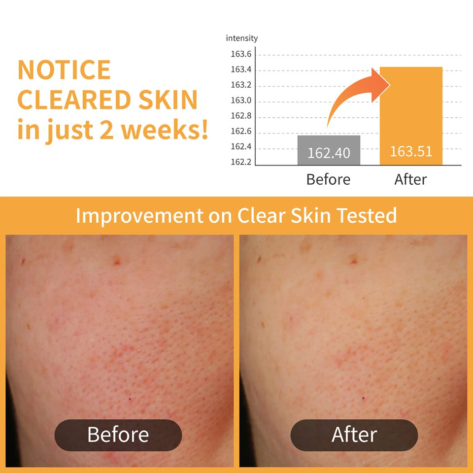 Numbuzin No.3 Radiance Glowing Jumbo Essence Pad | Vegan Pad, Unbleached, Biodegradable, Niacinamide, Clear Glass Skin, Korean Skin Care For Face | 70 Pads/5.07 Fl Oz Numbuzin No.3 Radiance Glowing Jumbo Essence Pad | Vegan Pad, Unbleached, Biodegradable, Niacinamide, Clear Glass Skin, Korean Skin Care For Face | 70 Pads/5.07 Fl Oz