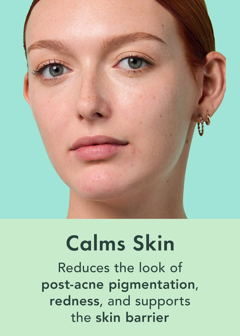 Rael Serum For Face, Miracle Clear Complete Acne Treatment - 1.5% Salicylic Acid, 2% Niacinamide, 0.5% Zinc, Pore Minimizer, Even Skin Tone, Korean Skincare (1Oz, 30Ml)