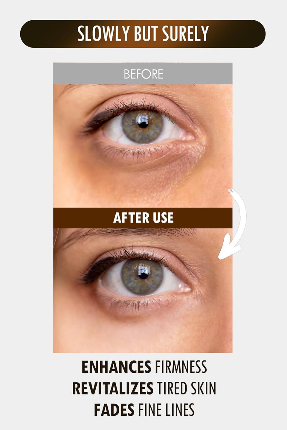 Sur.Medic+ 24K Gold Perfection All In One Cream For Face & Eye With Hyaluronic Acid, Panthenol And 24 Gold 1.18 Oz