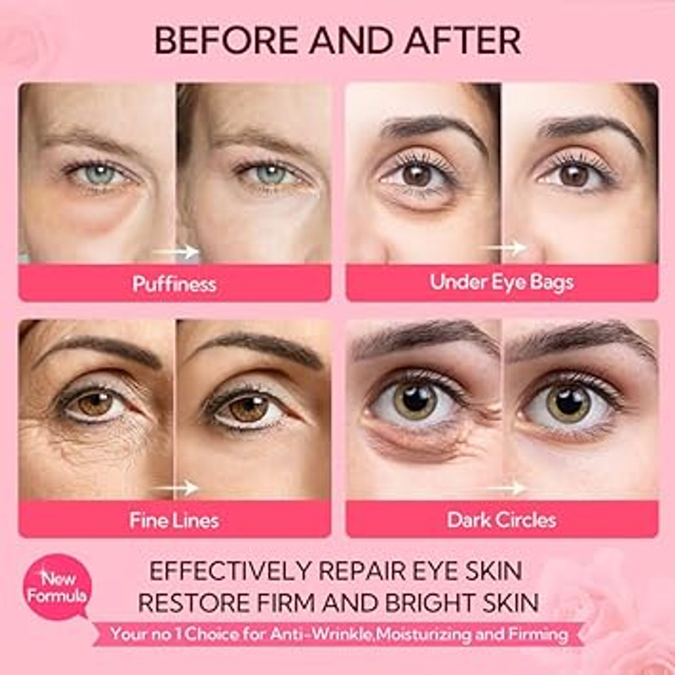 Under Eye Mask - 30 Pairs -Lanbrna Rose Eye Mask For Sleeping- Puffy Eyes & Dark Circles Treatments With Hyaluronic Acid, Reduce Under Eye Bags And Smooth Wrinkles, Brighten Complexionpink