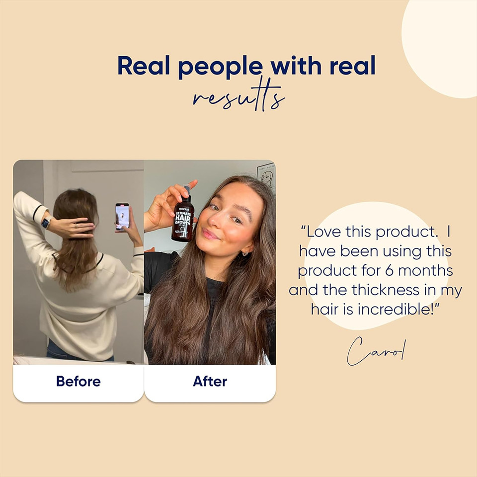 Moerie Ultimate Hair Boost Spray Designed To Strengthen Hair & Restore Scalp Health - 100% Natural Hair Serum For Hair Boost With Over 100 Minerals, Vitamins & Amino Acids - Fresh Scent - 5.07 Fl. Oz