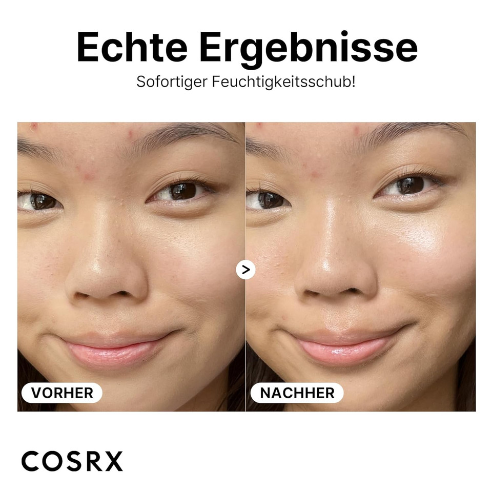 Cosrx Pure Sodium Hyaluronic Acid 3% Serum, Hydration & Moisture Boosting Facial Serum For Fine Lines & Wrinkles, Plump & Repair Dry Skin, 0.67Fl.Oz/20Ml, No Artificial Fragrance, Korean Skin Care