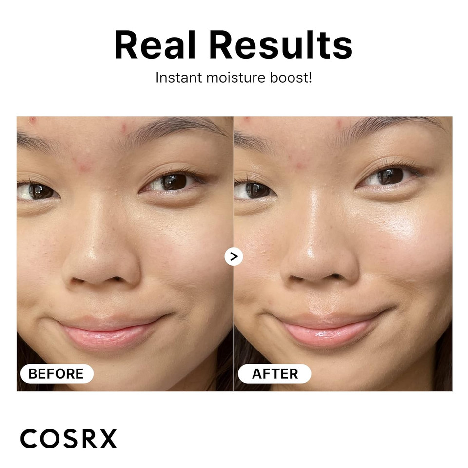 Cosrx Pure Sodium Hyaluronic Acid 3% Serum, Hydration & Moisture Boosting Facial Serum For Fine Lines & Wrinkles, Plump & Repair Dry Skin, 0.67Fl.Oz/20Ml, No Artificial Fragrance, Korean Skin Care