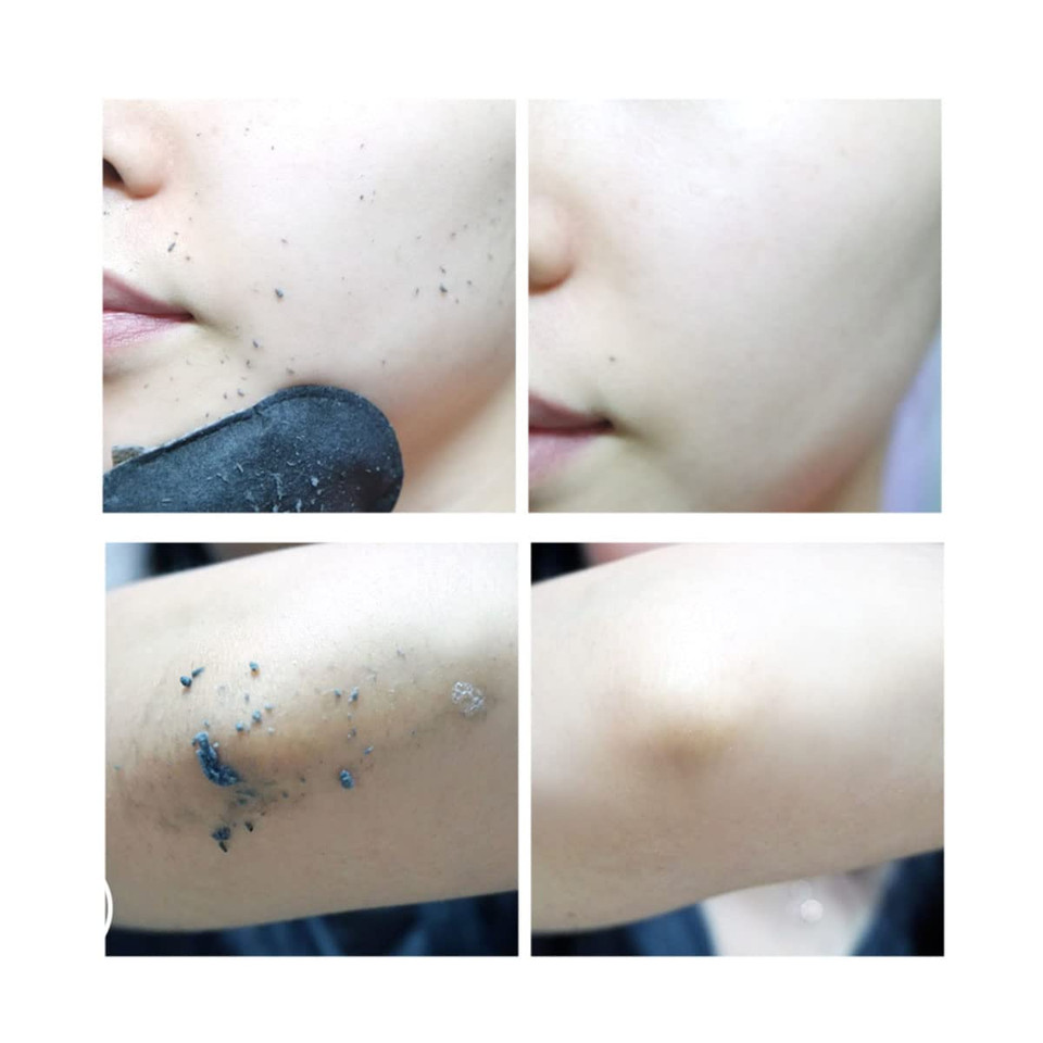 All Kill Black Peeling Pad By Rire_6G10 Pads