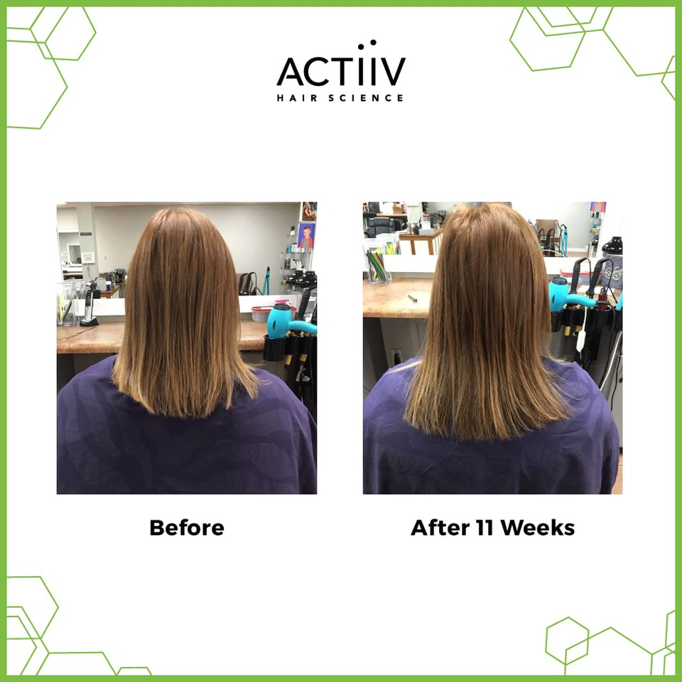 Actiiv Renew Healing Cleansing Treatment, 6 Fl Oz