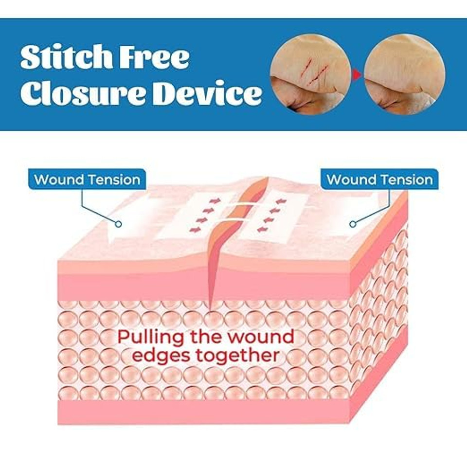 Emergency Stitches Bandage- Hospital-Grade Rapid Skin Closure for First Aid, Surgical Repair at Home and Outdoors