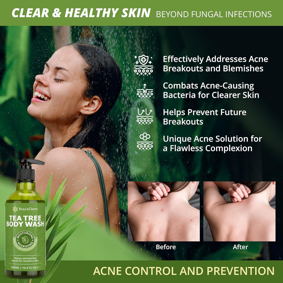 Tea Tree Oil Antifungal Soap  Antifungal Treatment for Face & Body Acne, Athlete's Foot, Tinea, Folliculitis Ringworm Jock Itch - Refresh & Cleanse with Natural Herbal Extracts