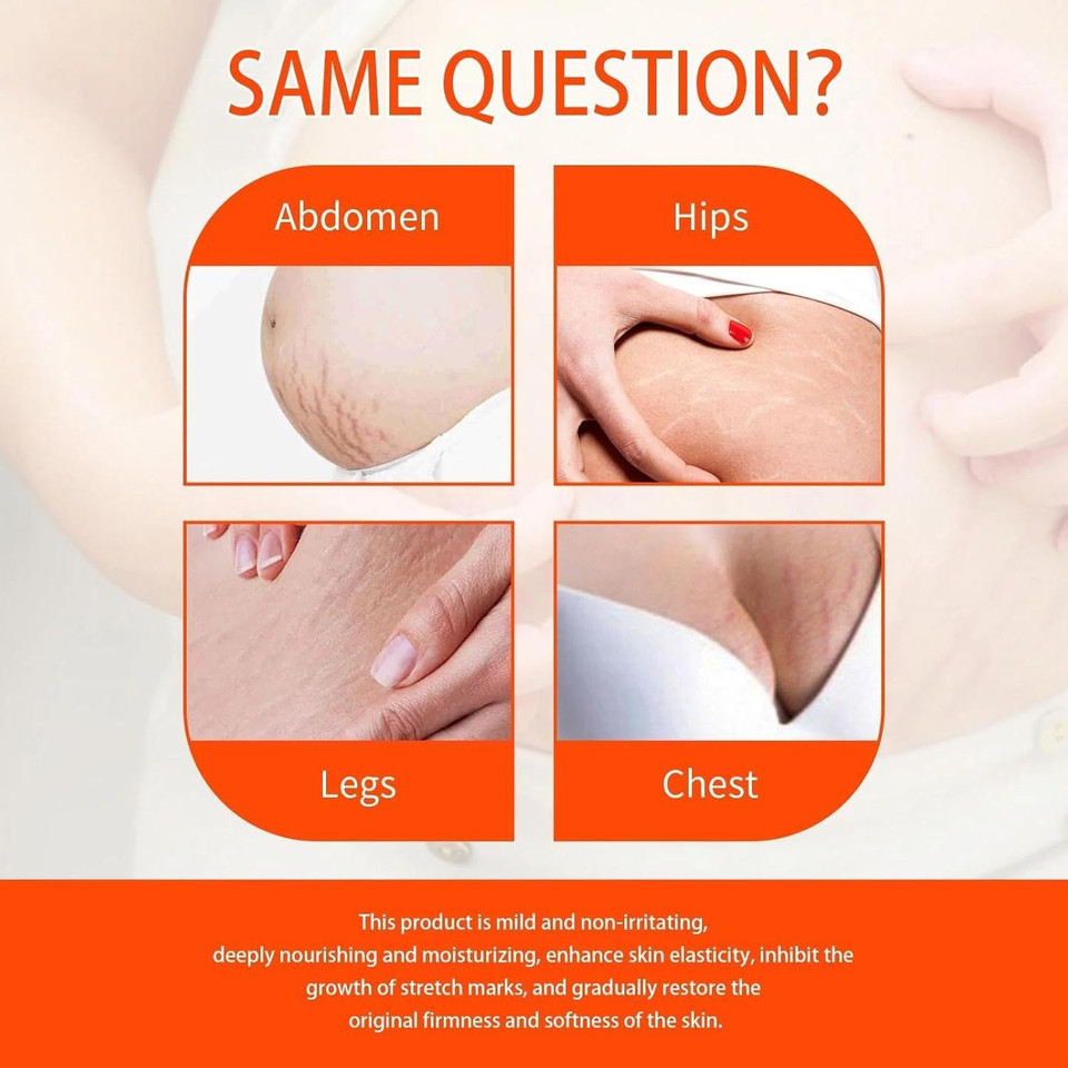 Stretch-Marks, Scar Treatment Oil - Boosts Collagen for Skin Lifting - Improves Treat of Scars, Stretch-Marks & Uneven Skin Tone - 125ml Stretch-Marks, Scar Treatment Oil - Boosts Collagen for Skin Lifting - Improves Treat of Scars, Stretch-Marks & Uneven Skin Tone - 125ml