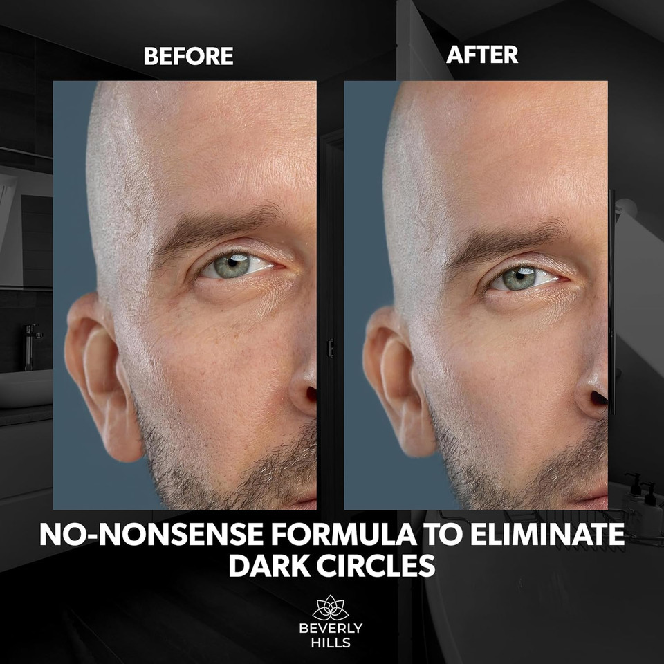 Beverly Hills Men's Dark Circle & Puffy Eye Treatment - Reduces Dark Circles