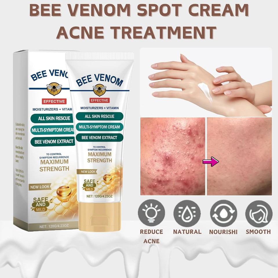Bee Venom Acne Cream for Face - Acne Treatment Cream with B-ee Venom,Salicylic Acid,Tocopherol - Spot Treatment Creams for Rosacea,Pimples,Redness - Bee Ve-nom Ac-ne Scar Treat-ment for All Skin Types