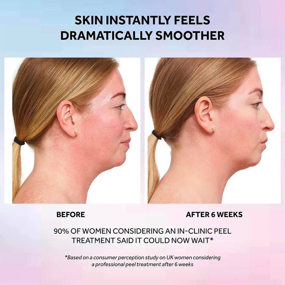 No7 laboratories Resurfacing Peel 15% Glycolic Acid Treatment