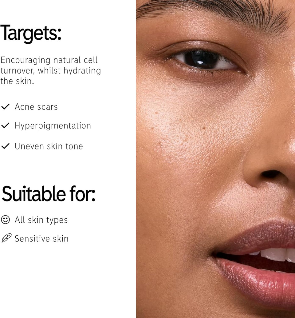 The INKEY List Mandelic Acid Treatment 15ml, Treats Hyperpigmentation, Fades Acne Marks, Fragrance-free, Suitable For All Skin Types