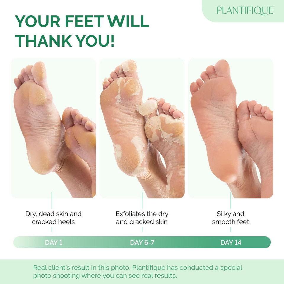 Plantifique Foot Peel Mask  2 Pairs Exfoliating & Dermatologically Tested Foot Treatment, Removes Dead Skin & Repairs Heels for Soft Feet  Peach Scent, Gift for Women & Men
