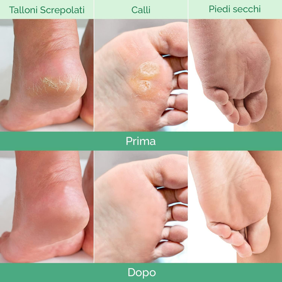 Plantifique Foot Peel Mask  4 Pairs Exfoliating & Dermatologically Tested Foot Treatment, Removes Dead Skin & Repairs Heels for Soft Feet  Mix Scent, Gift for Women & Men