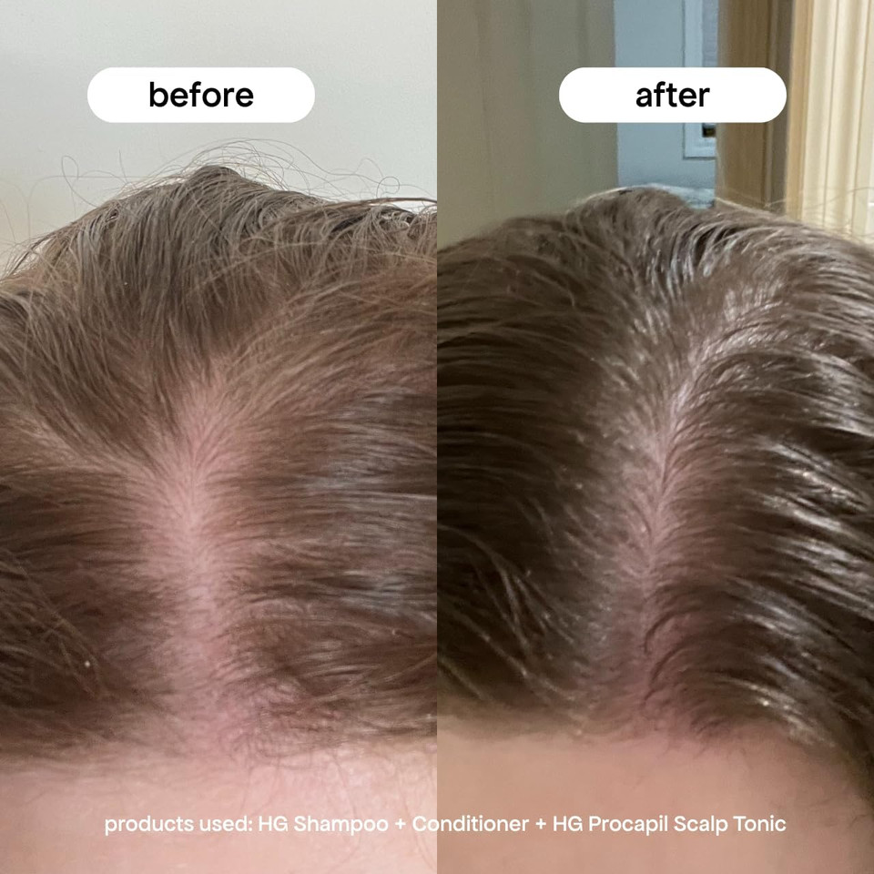 BondiBoost HG Anti-Thinning Procapil Scalp Tonic - PM Treatment with 3% Procapil, Rosemary Extract & Horsetail Leaf for Fuller, Denser-Looking Hair - Vegan & Cruelty-Free, 100ml