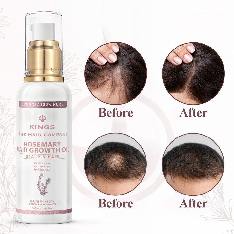 Kings 100% Natural Rosemary Oil with Biotin, Promotes Hair Growth & Prevents Loss, Organic Rosemary Oil for Hair Growth - Hair fall Solution for Dry, Damaged Hair for Men and Women  100 ml